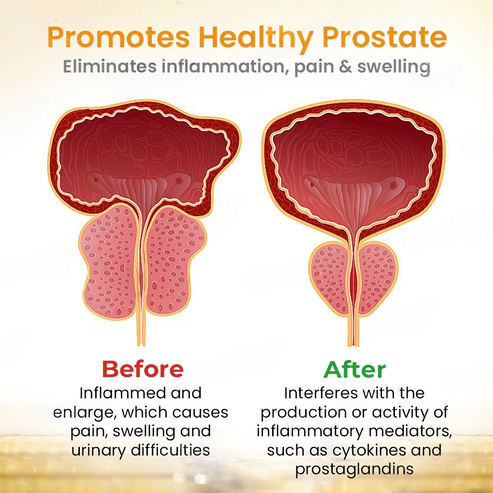 🔥LOVILDS™ Bee Detox Prostate Care Patch